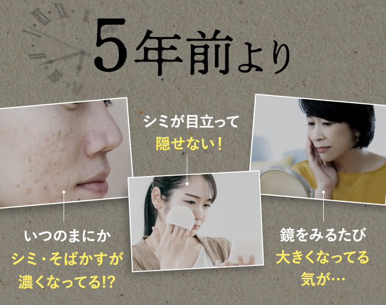 5年前よりシミが目立って隠せない！